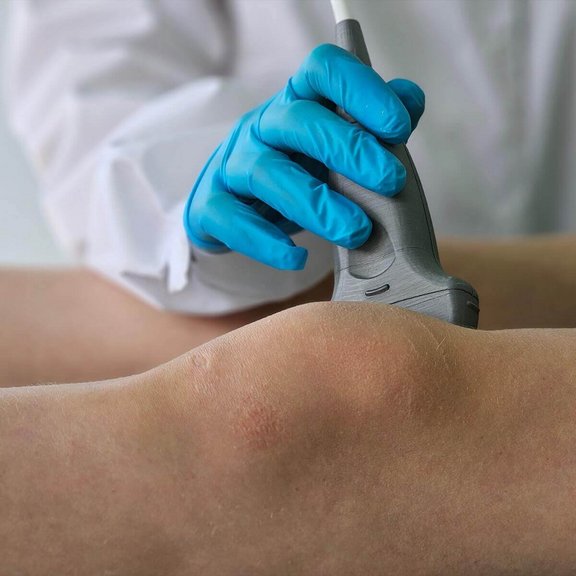 Ortho-Energy-Meniskusverletzung-3.jpg