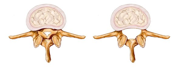 Ortho-Energy-Headerbild-Spinalkanalstenose.jpg 
