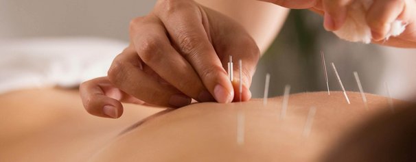 Ortho-Energy-Headerbild-Akupunktur.jpg 