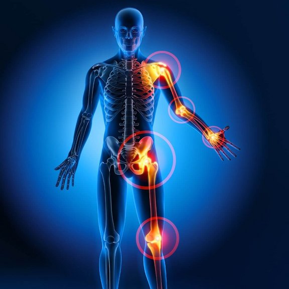 Ortho-Energy-Arthrose-1.jpg