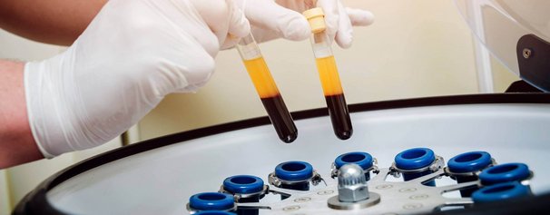 Ortho-Energy-Headerbild-Eigenblut.jpg 